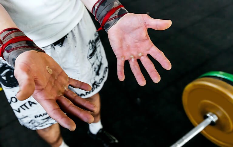 man with CALLUSES on his hands due to lifting weights